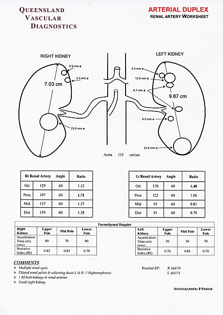 Carotid Ultrasound Worksheet Free Worksheets Library