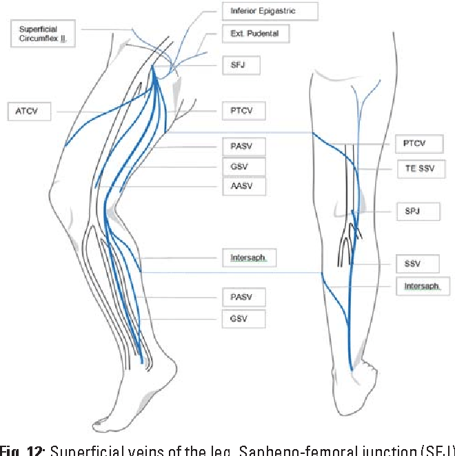 Duplex Ultrasound In The Assessment Of Lower Extremity Venous